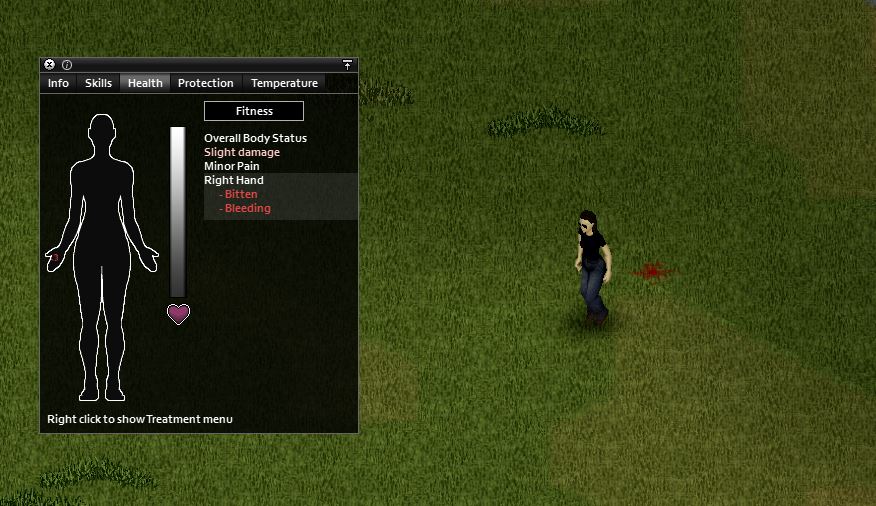 getting bitten in project zomboid. The image shows a player who has been bitten on the right hand by a zombie